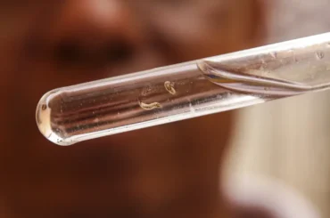 Dengue: quase todos os estados brasileiros têm tendência de queda