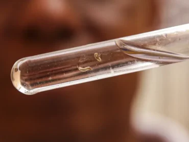 Dengue: quase todos os estados brasileiros têm tendência de queda